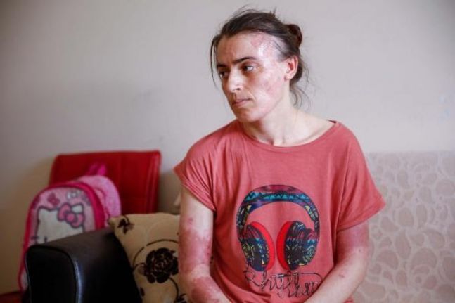 Gaziosmanpaşa'da şizofreni elti dehşeti! 2 çocuk annesi genç kadını 17 defa bıçaklayıp üzerine kaynar su döktü