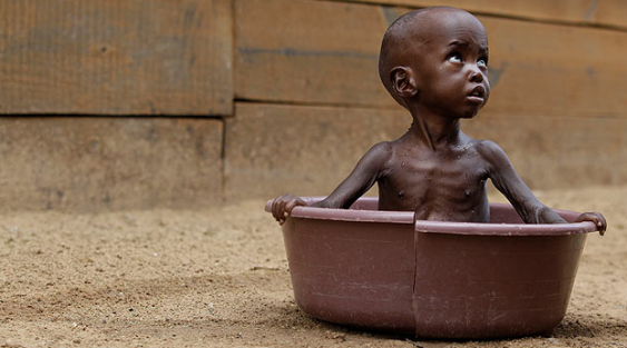 Somali'de 6 çocuk daha açlıktan öldü!