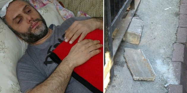 Sultangazi'de kafasına beton parçası düştü ölümden döndü