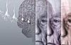 Alzheimer hastalarına müjde