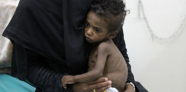 Yemen'de kıtlık en çok çocukları vuruyor