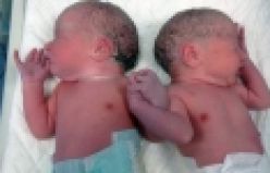 İkizlerin tıklanma rekoru kıran pozu